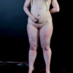 Pic of Breast Hanging And Tears