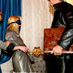 Pic of Extreme welts of singletail