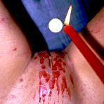 Pic of Shocking Pain (shockingpain)