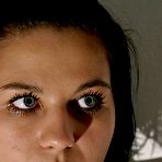 Pic of LUPUS SPANKING - free spanking on BDSMBook.com