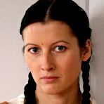 Pic of LUPUS SPANKING - free spanking on BDSMBook.com