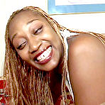 Pic of Black Ass Fever!!
