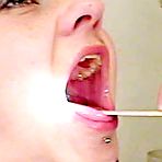 Pic of Rhoda squirts a white liquid out her muff when gyno checked up