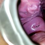 Pic of Tina fuck hole gaping and medical instrument examination by older doc