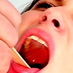 Pic of Elder gyno professor examination Penny minge with his finger and gyno tools