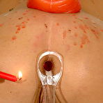 Pic of Bizarre Medical Pussy Pain