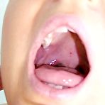 Pic of Misa  extreme gyno exploration muff closeups at gyno clinic