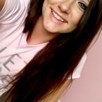 Pic of Freckles 18 