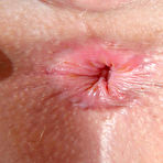 Pic of Amazing Assholes