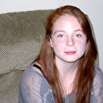 Pic of Rehdead Amateur Teen With Freckles Shows Hairy Pussy