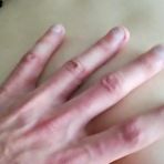 Pic of Chernihiv natalka prdeli do zadku - AmateurPorn