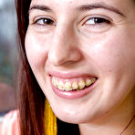 Pic of Close ups of braces adorned amateur Andreea showing off big natural tits